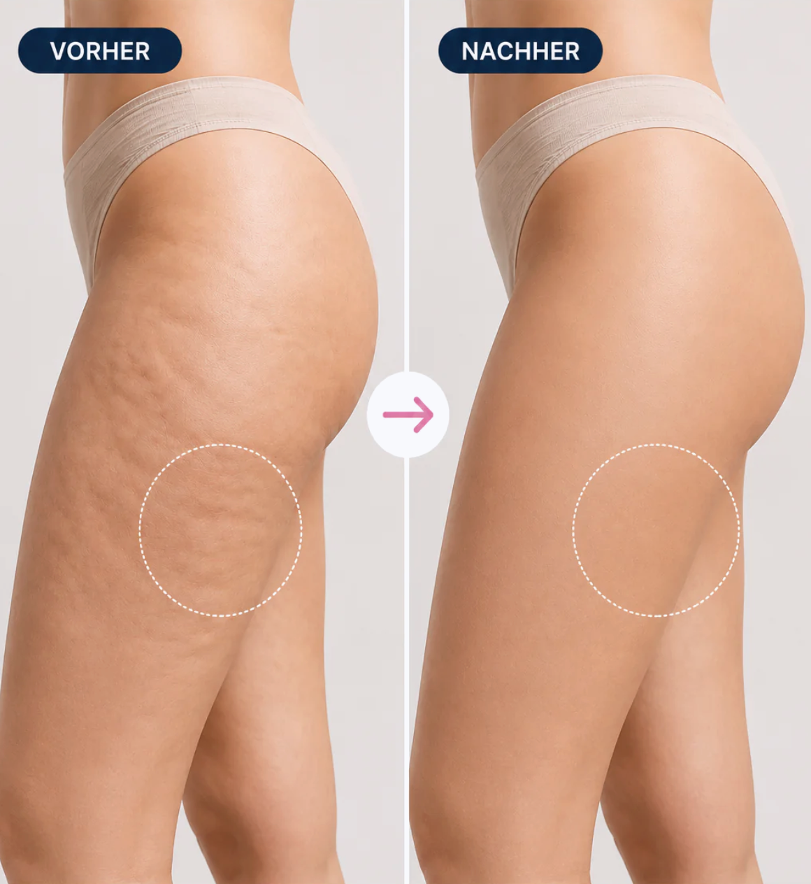 Lumivé™ Elektrisches Gua Sha Massagegerät
